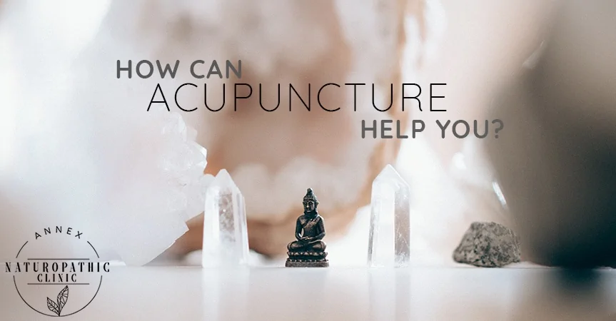 How Can Acupuncture Help You? | Annex Naturopathic Clinic | Toronto Naturopathic Doctors