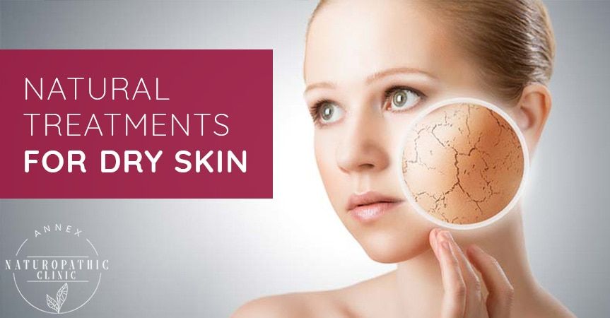 Natural Treatments For Dry Skin | Annex Naturopathic Clinic | Toronto Naturopathic Doctors
