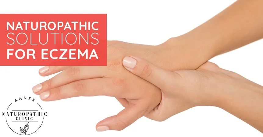 Naturopathic Solutions For Eczema | Annex Naturopathic Clinic | Toronto Naturopathic Doctors
