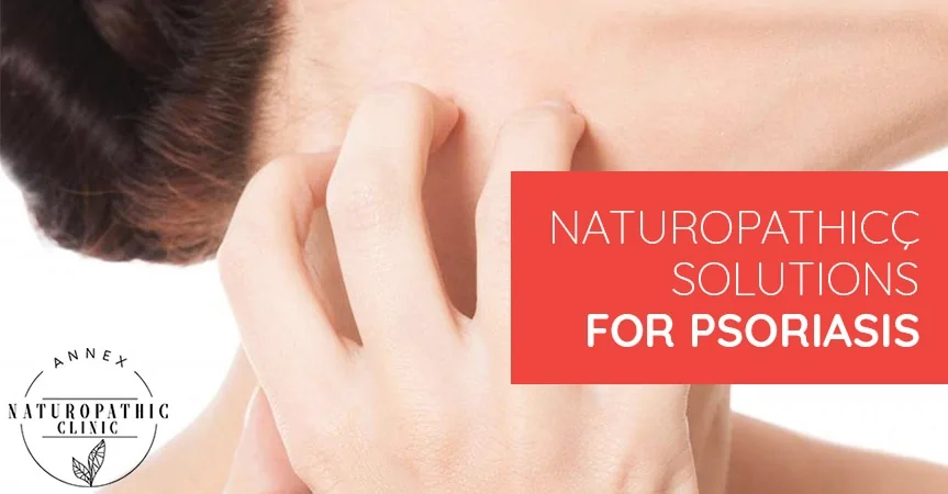 Naturopathic Solutions For Psoriasis | Annex Naturopathic Clinic | Toronto Naturopathic Doctors