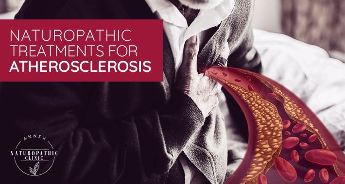 Naturopathic Treatments For Atherosclerosis | Annex Naturopathic Clinic | Toronto Naturopathic Doctors