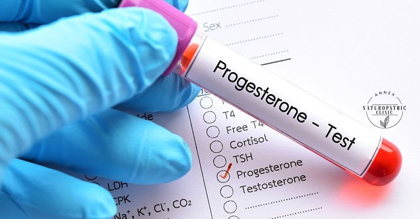 Progesterone Therapy to reduce menopause | Annex Naturopathic Clinic | Toronto Naturopathic Doctors