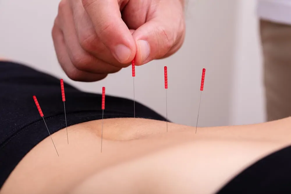 stomach acupuncture to treat urinary incontinence