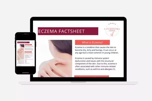 Eczema Handout